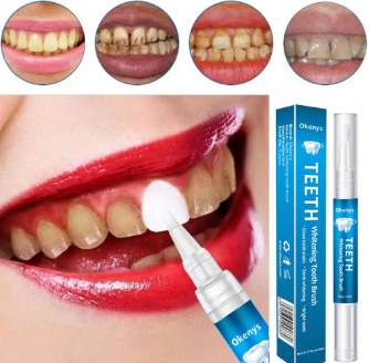 Matita Sbiancante per Denti